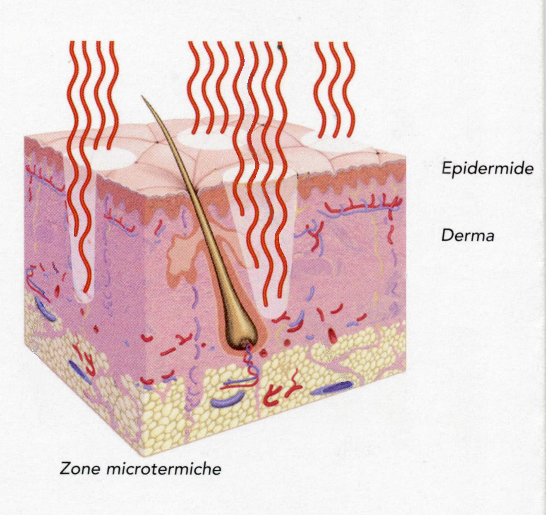 Medicina Estetica Laser Frazionale